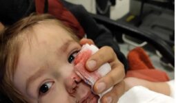 Ankara’da minik Efe’ye saldırın pitbullun sahibi: Koruma içgüdüsüyle yaptı
