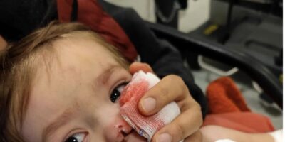Ankara’da minik Efe’ye saldırın pitbullun sahibi: Koruma içgüdüsüyle yaptı