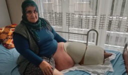 Mersin’de fil hastalığıyla mücadele ediyor