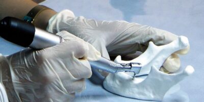 SGK implant tedavisini karşılıyor mu? Ücretsiz implant şartları 2025